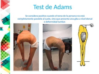 Adams Test ESCOLIOSIS manejo desde atencion primaria paciente con escoliosis.pptx