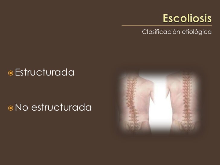 Escoliosis Estructurada Y No Estructurada Escoliosis