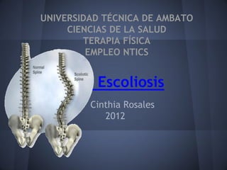 UNIVERSIDAD TÉCNICA DE AMBATO
     CIENCIAS DE LA SALUD
        TERAPIA FÍSICA
         EMPLEO NTICS


          Escoliosis
         Cinthia Rosales
            2012
 