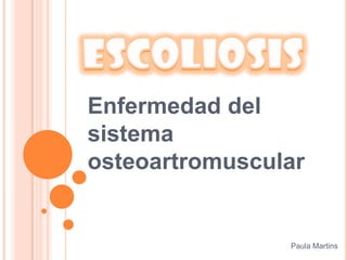 Escoliosis Enfermedad del sistema osteoartromuscular Paula Martins 