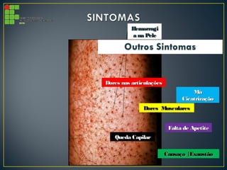 HemorragiHemorragi
a na Pelea na Pele
Dores nas articulaçõesDores nas articulações
Queda CapilarQueda Capilar
Cansaço |ExaustãoCansaço |Exaustão
Falta de ApetiteFalta de Apetite
MáMá
CicatrizaçãoCicatrização
Dores MuscularesDores Musculares
 