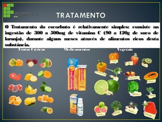 O Tratamento do escorbuto é relativamente simples: consiste naO Tratamento do escorbuto é relativamente simples: consiste na
ingestão de 300 a 500mg de vitamina C (90 a 120g de suco deingestão de 300 a 500mg de vitamina C (90 a 120g de suco de
laranja), durante alguns meses através de alimentos ricos destalaranja), durante alguns meses através de alimentos ricos desta
substância.substância.
Frutas CítricasFrutas Cítricas VegetaisVegetaisMedicamentosMedicamentos
 