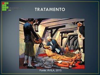 Fonte: ÁVILA, 2013.
 