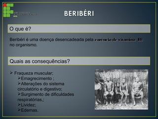 O que é?
Beribéri é uma doença desencadeada pela carência de vitamina B1carência de vitamina B1
no organismo. 
Quais as consequências?
 Fraqueza muscular;
Emagrecimento ;
Alterações do sistema
circulatório e digestivo;
Surgimento de dificuldades
respiratórias,;
Lividez;
Edemas.
 