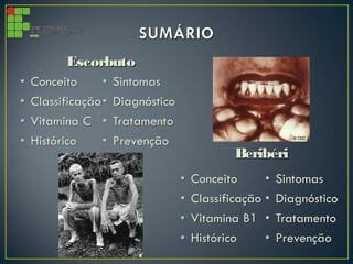 EscorbutoEscorbuto
BeribériBeribéri
 