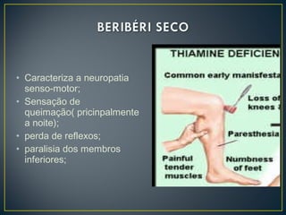 • Caracteriza a neuropatia
senso-motor;
• Sensação de
queimação( pricinpalmente
a noite);
• perda de reflexos;
• paralisia dos membros
inferiores;
 