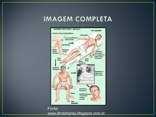 Fonte:
www.drcarlosrey.blogspot.com.br
 