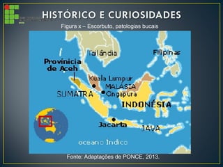 Figura x – Escorbuto, patologias bucais
Fonte: Adaptações de PONCE, 2013.
 