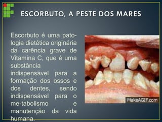 Escorbuto é uma pato-
logia dietética originária
da carência grave de
Vitamina C, que é uma
substância
indispensável para a
formação dos ossos e
dos dentes, sendo
indispensável para o
me-tabolismo e
manutenção da vida
humana.
 
