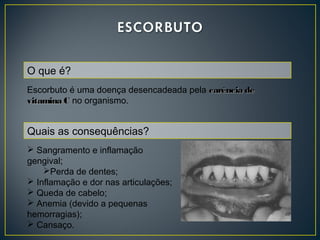O que é?
Escorbuto é uma doença desencadeada pela carência decarência de
vitamina Cvitamina C no organismo. 
Quais as consequências?
 Sangramento e inflamação
gengival;
Perda de dentes;
 Inflamação e dor nas articulações;
 Queda de cabelo;
 Anemia (devido a pequenas
hemorragias);
 Cansaço.
 