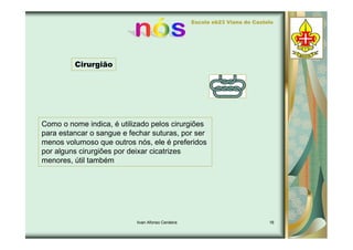 Tipos de Nós - Ivan 7d