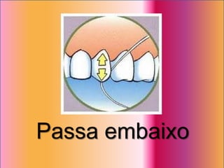 Passa embaixo
 