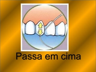 Passa em cima
 