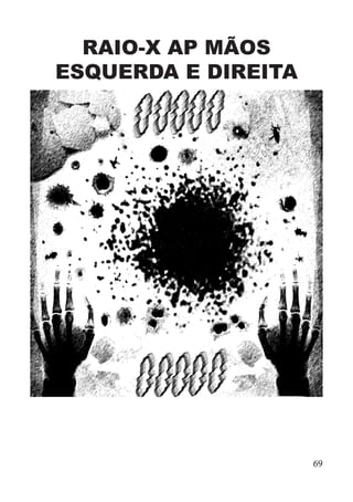 RAIO-X AP MÃOS
ESQUERDA E DIREITA
69
 