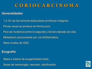 C O R I O C A R C I N O M A Generalidades 1 a 3% de los tumores testiculares primitivos malignos. Pocas veces se produce en forma pura. Pico de incidencia entre la segunda y tercera década de vida. Metastizan precozmente por vía linfohemática.  Altos niveles de HGC. Ecografía Masa o nódulo de ecogenicidad mixta. Áreas de hemorragia, necrosis, calcificación. 