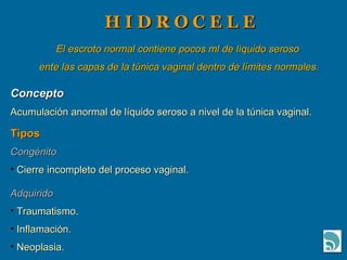 H I D R O C E L E  El escroto normal contiene pocos ml de líquido seroso  ente las capas de la túnica vaginal dentro de límites normales. Concepto Acumulación anormal de líquido seroso a nivel de la túnica vaginal. Tipos Congénito Cierre incompleto del proceso vaginal. Adquirido Traumatismo. Inflamación. Neoplasia. 