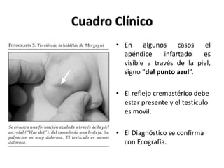 Cuadro Clínico
       • En algunos casos el
         apéndice     infartado   es
         visible a través de la piel,
         signo “del punto azul”.

       • El reflejo cremastérico debe
         estar presente y el testículo
         es móvil.

       • El Diagnóstico se confirma
         con Ecografía.
 