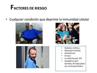 FACTORES DE RIESGO
• Cualquier condición que deprime la inmunidad celular




                                    •   Diabetes mellitus .
                                    •   Obesidad mórbida
                                    •   Alcoholismo
                                    •   Cirrosis
                                    •   La infección por VIH
                                    •   iatrogénica (por
                                        ejemplo, de largo plazo
                                        con corticosteroides)
 