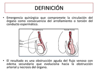 DEFINICIÓN
• Emergencia quirúrgica que compromete la circulación del
  órgano como consecuencia del arrollamiento o torsión del
  conducto espermático.




• El resultado es una obstrucción aguda del flujo venoso con
  edema secundario que evoluciona hacia la obstrucción
  arterial y necrosis del órgano.
 