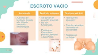 ESCROTO VACIO
Anorquidia
• Ausencia de
testículo. Debido
a la falta de
formación
embriológica.
Testículo ectópico
• Se ubican en
posición anormal.
• No son
funcionales.
• Pueden ser:
Prepeniano,
perineal, femoral
o superficial.
Testículo retráctil
• Testículo en
ascensor.
• Resulta del reflejo
cremasterico
exacerbado
• Reascenso
probable.
 