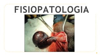 FISIOPATOLOGIA
9
 