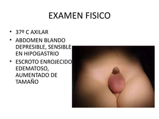 EXAMEN FISICO 37º C AXILAR ABDOMEN BLANDO DEPRESIBLE, SENSIBLE EN HIPOGASTRIO  ESCROTO ENROJECIDO, EDEMATOSO, AUMENTADO DE TAMAÑO 