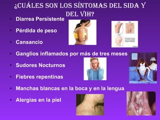 ¿Cuáles SON LOS SÍNTOMAS DEL SIDA Y DEL VIH? Diarrea Persistente Pérdida de peso Cansancio Ganglios inflamados por más de tres meses Sudores Nocturnos Fiebres repentinas Manchas blancas en la boca y en la lengua Alergias en la piel ANd9GcROkg-WMGTO4QDHIykdMe0QfLxFYqaweVFhJkMyOrI8a31tXCwoU2Sn9uSN ANd9GcQscBNvrK6GVXpp7ZeZ54QuBMnMdAXllGOuEZXSt7_G6LnNKm6GWxWpsMs image009 ANd9GcQxXmIww6H8iv5zW-PifN2FTNEglX7t5Axjr_6mhjNpv_JG9CCcWzbNzso ANd9GcTkoLw1ryvT06yvUYpNbw4G-c9323RwjAz5N8ocRC6sff_ebiIim2F-rA ANd9GcSHKFVHyo5L4SjdAvucKKrRyy42LjCJedXUNh2biEs5tx4LeK7Mvz00AA 