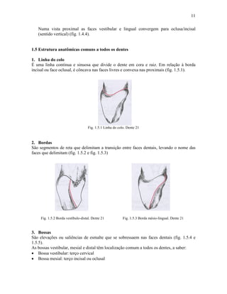 11

   Numa vista proximal as faces vestibular e lingual convergem para oclusa/incisal
   (sentido vertical) (fig. 1.4.4).


1.5 Estrutura anatômicas comuns a todos os dentes

1. Linha do colo
É uma linha contínua e sinuosa que divide o dente em cora e raiz. Em relação à borda
incisal ou face oclusal, é côncava nas faces livres e convexa nas proximais (fig. 1.5.1).




                                    Fig. 1.5.1 Linha do colo. Dente 21



2. Bordas
São segmentos de reta que delimitam a transição entre faces dentais, levando o nome das
faces que delimitam (fig. 1.5.2 e fig. 1.5.3)




     Fig. 1.5.2 Borda vestíbulo-distal. Dente 21           Fig. 1.5.3 Borda mésio-lingual. Dente 21


3. Bossas
São elevações ou saliências de esmalte que se sobressaem nas faces dentais (fig. 1.5.4 e
1.5.5).
As bossas vestibular, mesial e distal têm localização comum a todos os dentes, a saber:
• Bossa vestibular: terço cervical
• Bossa mesial: terço incisal ou oclusal
 