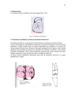 15



7. Borda Incisal
É o encontro da face vestibular com a face lingual (fig. 1.6.4).




                                Fig. 1.6.3 Borda incisal. Dente 21

1.7 Estruturas anatômicas exclusivas dos Dentes Posteriores

Nos dentes posteriores, as estruturas de maior interesse se localizam nas faces oclusais.
A face oclusal pode ser classificada em anatômica e funcional. Entendes-se por face oclusal
anatômica a região contida entre as arestas longitudinais das cúspides e as arestas das
cristas marginais transversais. Durante a fisiologia mastigatória não é apenas a face oclusal
anatômica que participa do processo de trituração dos alimentos. Portanto, a face oclusal
funcional corresponde à face oclusal anatômica acrescida dos terços oclusais das faces
linguais superiores e terços oclusais das faces vestibulares inferiores.
As faces oclusais anatômicas apresentam uma série de elementos descritivos, os quais
detalharemos a seguir.
 
