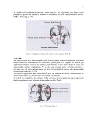 17

A cúspide mésio-palatina do primeiro molar superior, por apresentar uma base virtual
pentagonal, possui três vertentes internas ou triturantes, as quais denominaremos mesial,
média e distal (fig. 1.7.4).




                 Fig. 1.7.4 Cúspide mési-lingual do primeiro molar superior. Dente 26

4. Arestas
São segmentos de retas formados pela união de vertentes de uma mesma cúspide ou de uma
crista transversal, normalmente em número de quatro para cada cúspide. As arestas que
separam as vertentes externas das internas, paralelamente ao eixo mesio-distal da coroa, são
denominadas arestas longitudinais. As arestas que separam duas vertentes internas ou
externas entre si, perpendicularmente ao eixo mésio-distal da coroa, são denominadas
arestas transversais (fig. 1.7.5).
As arestas longitudinais são ainda classificadas em mesiais ou distais, enquanto que as
arestas transversais são classificadas em internas ou externas.
A cúspide mésio-palatina do primeiro molar superios, como exceção às regras, apresenta
duas arestas transversais internas, denominadas mesial e distal.




                                     Fig. 1.7.5 Arestas. Dente 37
 