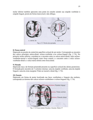 19

molar inferior também apresenta uma ponte de esmalte unindo sua cúspide vestibular à
cúspide lingual, porem de forma transversal e não oblíqua.




8. Fossa central
Depressão na porção da central da superfície oclusal de um molar. Corresponde ao encontro
dos sulcos principais mésio-distal, ocluso-vestibular e/ou ocluso-lingual (fig. 1.7.8). No
primeiro molar onferior, considera-se o encontro entre os sulcos mésio-distal, sulco acluso-
vestibular-mesial e ocluso-lingual como fossa central e o encontro entre o sulco ocluso-
vestibular-distal e o sulco mésio-distal como fossa distal.

9. Fóssula
Depressão rasa e de formato piramidal presente na superfície oclusal dos dentes posteriores.
É formada pelo encontro de 3 vertentes internas: uma da cúspide vestibular, uma da cúspide
lingual e uma da crista marginal. Pode ser mesial e distal (fig. 1.7.8).

10. Fosseta
Depressão em forma de ponta localizada nas faces vestibulares e linguais dos molares,
corresponde ao término dos culcos oclusos-vestibulares e ocluso-linguais (fig. 1.7.8).




                       Fig. 1.7.8 Fossa central, fóssulas e fossetas. Dente 37
 