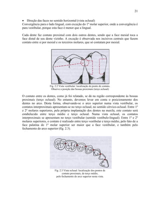 21


• Direção das faces no sentido horizontal (vista oclusal)
Convergência para o lado lingual, com exceção do 1º molar superior, onde a convergência é
para vestibular, porque esta face é menor que a lingual.

Cada dente faz contato proximal com dois outros dentes, sendo que a face mesial toca a
face distal de seu dente vizinho. A exceção é observada nos incisivos centrais que fazem
contato entre si por mesial e os terceiros molares, que só contatam por mesial.




                      Fig. 2.2 Vista vestibular: localização do ponto de contato.
                       Observe a posição das bossas proximais (terço oclusal)

O contato entre os dentes, como já foi relatado, se dá na região correspondente às bossas
proximais (terço oclusal). No entanto, devemos levar em conta o posicionamento dos
dentes no arco. Desta forma, observando-se o arco superior numa vista vestibular, os
contatos interproximais apresentam-se no terço oclusal, no sentido cérvico-oclusal. Entre 1º
e 2º molares superiores, pela própria implantação dos dentes na maxila, este contato será
estabelecido entre terço médio e terço oclusal. Numa vista oclusal, os contatos
interproximais se apresentam no terço vestibular (sentido vestíbulo-lingual). Entre 1º e 2º
molares superiores, o contato é realizado entre terço vestibular e terço médio, pelo fato de a
face palatina do 1º molar superior ser maior que a face vestibular, e também pelo
fechamento do arco superior (fig. 2.3).




                          Fig. 2.3 Vista oclusal: localização dos pontos de
                                 contato proximais, de terço médio,
                           pelo fechamento do arco superior nesta vista.
 