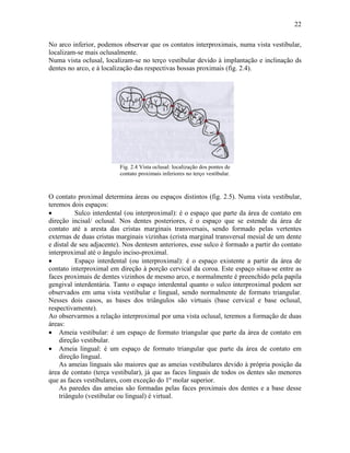 22

No arco inferior, podemos observar que os contatos interproximais, numa vista vestibular,
localizam-se mais oclusalmente.
Numa vista oclusal, localizam-se no terço vestibular devido à implantação e inclinação ds
dentes no arco, e à localização das respectivas bossas proximais (fig. 2.4).




                         Fig. 2.4 Vista oclusal: localização dos pontes de
                         contato proximais inferiores no terço vestibular.



O contato proximal determina áreas ou espaços distintos (fig. 2.5). Numa vista vestibular,
teremos dois espaços:
•         Sulco interdental (ou interproximal): é o espaço que parte da área de contato em
direção incisal/ oclusal. Nos dentes posteriores, é o espaço que se estende da área de
contato até a aresta das cristas marginais transversais, sendo formado pelas vertentes
externas de duas cristas marginais vizinhas (crista marginal transversal mesial de um dente
e distal de seu adjacente). Nos dentesm anteriores, esse sulco é formado a partir do contato
interproximal até o ângulo inciso-proximal.
•         Espaço interdental (ou interproximal): é o espaço existente a partir da área de
contato interproximal em direção à porção cervical da coroa. Este espaço situa-se entre as
faces proximais de dentes vizinhos de mesmo arco, e normalmente é preenchido pela papila
gengival interdentária. Tanto o espaço interdental quanto o sulco interproximal podem ser
observados em uma vista vestibular e lingual, sendo normalmente de formato triangular.
Nesses dois casos, as bases dos triângulos são virtuais (base cervical e base oclusal,
respectivamente).
Ao observarmos a relação interproximal por uma vista oclusal, teremos a formação de duas
áreas:
• Ameia vestibular: é um espaço de formato triangular que parte da área de contato em
    direção vestibular.
• Ameia lingual: é um espaço de formato triangular que parte da área de contato em
    direção lingual.
    As ameias linguais são maiores que as ameias vestibulares devido à própria posição da
área de contato (terça vestibular), já que as faces linguais de todos os dentes são menores
que as faces vestibulares, com exceção do 1º molar superior.
    As paredes das ameias são formadas pelas faces proximais dos dentes e a base desse
    triângulo (vestibular ou lingual) é virtual.
 