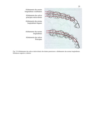 25
                    Alinhamento das arestas
                   longitudinais vestibulares

                    Alinhamento dos sulcos
                    principais mésio-distais

                    Alinhamento das arestas
                      longitudinais linguais




                    Alinhamento das arestas
                             longitudinais

                    Alinhamento dos sulcos
                                Principais




Fig. 2.8 Alinhamento dos sulcos mésio-distais dos dentes posteriores e alinhamento das arestas longitudinais.
Hemiarcos superior e inferior.
 