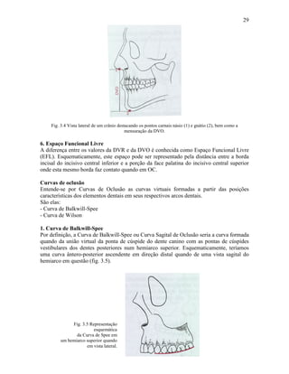 29




    Fig. 3.4 Vista lateral de um crânio destacando os pontos carnais násio (1) e gnátio (2), bem como a
                                            mensuração da DVO.

6. Espaço Funcional Livre
A diferença entre os valores da DVR e da DVO é conhecida como Espaço Funcional Livre
(EFL). Esquematicamente, este espaço pode ser representado pela distância entre a borda
incisal do incisivo central inferior e a porção da face palatina do incisivo central superior
onde esta mesmo borda faz contato quando em OC.

Curvas de oclusão
Entende-se por Curvas de Oclusão as curvas virtuais formadas a partir das posições
características dos elementos dentais em seus respectivos arcos dentais.
São elas:
- Curva de Balkwill-Spee
- Curva de Wilson

1. Curva de Balkwill-Spee
Por definição, a Curva de Balkwill-Spee ou Curva Sagital de Oclusão seria a curva formada
quando da união virtual da ponta de cúspide do dente canino com as pontas de cúspides
vestibulares dos dentes posteriores num hemiarco superior. Esquematicamente, teríamos
uma curva ântero-posterior ascendente em direção distal quando de uma vista sagital do
hemiarco em questão (fig. 3.5).




              Fig. 3.5 Representação
                         esquemática
                da Curva de Spee em
         um hemiarco superior quando
                     em vista lateral.
 