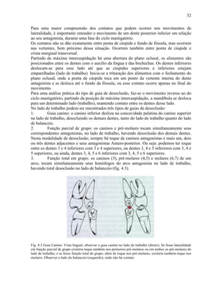 32

Para uma maior compreensão dos contatos que podem ocorrer nos movimentos de
lateralidade, é importante entender o movimento de um dente posterior inferior em relação
ao seu antagonista, durante uma fase do ciclo mastigatório.
Os contatos não se dão exatamente entre ponta de cúspide e fundo de fóssula, mas ocorrem
nas vertentes, bem próximo dessa situação. Ocorrem também entre ponta de cúspide e
crista marginal transversal.
Partindo de máxima intercuspidação há uma abertura do plano oclusal, os alimentos são
posicionados entre os dentes com o auxílio da língua e das bochechas. Os dentes inferiores
deslocam-se para esse lado até que as cúspides superiores e inferiores estejam
emparelhadas (lado de trabalho). Inicia-se a trituração dos alimentos com o fechamento do
plano oclusal, onde a ponta de cúspide toca em um ponto da vertente interna do dente
antagonista e se desloca até o fundo da fóssula, ou esse contato ocorre apenas no final do
movimento.
Para uma análise prática do tipo de guia de desoclusão, faz-se o movimento inverso ao do
ciclo mastigatório, partindo da posição de máxima intercuspidação, a mandíbula se desloca
para um determinado lado (trabalho), mantendo contato entre os dentes desse lado.
No lado de trabalho podem ser encontrados três tipos de guias de desoclusão:
1.        Guia canino: o canino inferior desliza na concavidade palatina do canino superior
na lado de trabalho, desocluindo os demais dentes, tanto do lado de trabalho quanto do lado
de balanceio.
2.        Função parcial de grupo: os caninos e pré-molares tocam simultaneamente seus
correspondentes antagonistas, no lado de trabalho, havendo desoclusão dos demais dentes.
Nesta modalidade de desoclusão, sempre há toque de caninos antagonistas e mais um, dois
ou três dentes adjacentes e seus antagonistas Antero-posterior. Ou seja: podemos ter toque
entre os dentes 3 e 4 inferiores com 3 e 4 superiores, ou dentes 3, 4 e 5 inferiores com 3, 4 e
5 superiores, ou ainda, dentes 3, 4, 5 e 6 inferiores com 3, 4, 5 e 6 superiores.
3.        Função total em grupo: os caninos (3), pré-molares (4,5) e molares (6,7) de um
arco, tocam simultaneamente seus homólogos do arco antagonista no lado de trabalho,
havendo total desoclusão no lado de balanceio (fig. 4.3).




Fig. 4.3 Guia Canino. Vista lingual, observar o guia canino no lado de trabalho (direto). Se fosse lateralidade
em função parcial de grupo existiria toque também nos primeiros pré-molares ou em ambos os pré-molares do
lado de trabalho; e se fosse função total de grupo, além de toque nos pré-molares, existiria também toque nos
molares. Observar o lado do balanceio (esquerdo), onde não há contato.
 
