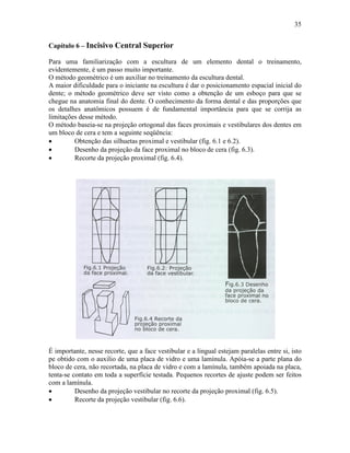 35


Capítulo 6 – Incisivo Central Superior

Para uma familiarização com a escultura de um elemento dental o treinamento,
evidentemente, é um passo muito importante.
O método geométrico é um auxiliar no treinamento da escultura dental.
A maior dificuldade para o iniciante na escultura é dar o posicionamento espacial inicial do
dente; o método geométrico deve ser visto como a obtenção de um esboço para que se
chegue na anatomia final do dente. O conhecimento da forma dental e das proporções que
os detalhes anatômicos possuem é de fundamental importância para que se corrija as
limitações desse método.
O método baseia-se na projeção ortogonal das faces proximais e vestibulares dos dentes em
um bloco de cera e tem a seguinte seqüência:
•        Obtenção das silhuetas proximal e vestibular (fig. 6.1 e 6.2).
•        Desenho da projeção da face proximal no bloco de cera (fig. 6.3).
•        Recorte da projeção proximal (fig. 6.4).




É importante, nesse recorte, que a face vestibular e a lingual estejam paralelas entre si, isto
pe obtido com o auxilio de uma placa de vidro e uma lamínula. Apóia-se a parte plana do
bloco de cera, não recortada, na placa de vidro e com a lamínula, também apoiada na placa,
tenta-se contato em toda a superfície testada. Pequenos recortes de ajuste podem ser feitos
com a lamínula.
•         Desenho da projeção vestibular no recorte da projeção proximal (fig. 6.5).
•         Recorte da projeção vestibular (fig. 6.6).
 