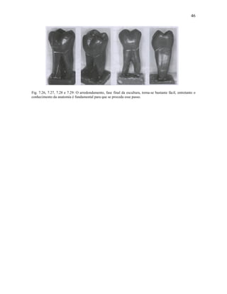 46




Fig. 7.26, 7.27, 7.28 e 7.29: O arredondamento, fase final da escultura, torna-se bastante fácil, entretanto o
conhecimento da anatomia é fundamental para que se proceda esse passo.
 