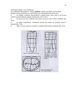 53

sendo duas linguais e três vestibulares.
As vestibulares denominam-se: mesial, mediana e distal, esta última a menor delas.
Durante a forma geométrica, as características as características do recorte são:
•        Na silhueta vestibular, desconsiderar a cúspide distal. Seria como se ela tivesse
contida na aresta distal da cúspide mediana (fig. 10.4 e 10.5).
•        No recorte da vista vestibular, não incluir recorte do sulco ocluso-vestibular (fig.
10.4).
•        As linhas longitudinais vestibulares partem das pontas de cúspides mesial e
mediana (fig. 10.4).
•        Após o recorte expulsivo, desenhar a cúspide distal da face vestibular (fig. 10.6).
 