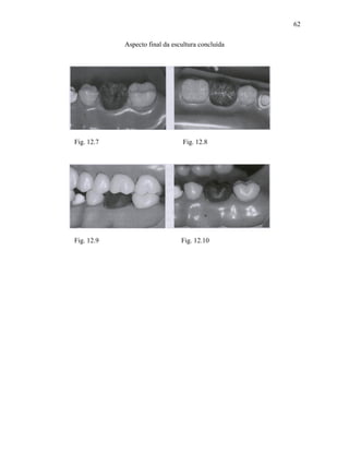 62

            Aspecto final da escultura concluída




Fig. 12.7                        Fig. 12.8




Fig. 12.9                       Fig. 12.10
 