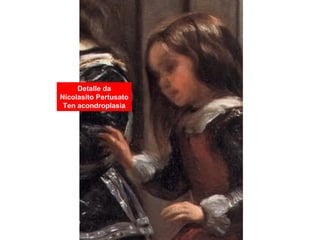 Detalle da
Nicolasito Pertusato
Ten acondroplasia
 