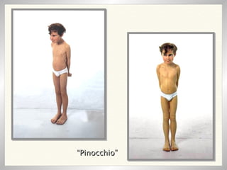 “ Pinocchio” 