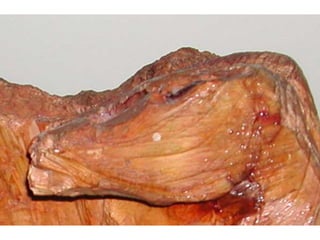 Esculturas en madera