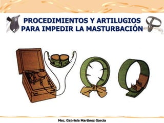 PROCEDIMIENTOS Y ARTILUGIOS
PARA IMPEDIR LA MASTURBACIÓN
Msc. Gabriela Martínez García
 