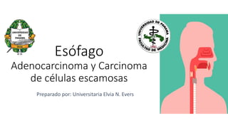 Esófago
Adenocarcinoma y Carcinoma
de células escamosas
Preparado por: Universitaria Elvia N. Evers
 