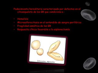 Padecimiento hereditario caracterizado por defectos en el
citoesqueleto de los GR que condiciona a :
•
•
•
•

Hemolisis
Microesferocitosis en el extendido de sangre periférica
Fragilidad osmótica de los GR
Respuesta clínica favorable a la esplenectomía

 