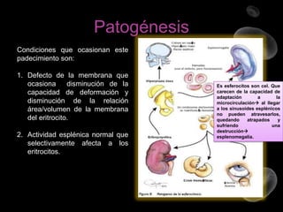 Patogénesis
Condiciones que ocasionan este
padecimiento son:
1. Defecto de la membrana que
ocasiona
disminución de la
capacidad de deformación y
disminución de la relación
área/volumen de la membrana
del eritrocito.
2. Actividad esplénica normal que
selectivamente afecta a los
eritrocitos.

Es esferocitos son cel. Que
carecen de la capacidad de
adaptación
a
la
microcirculación al llegar
a los sinusoides esplénicos
no pueden atravesarlos,
quedando
atrapados
y
sufriendo
una
destrucción
esplenomegalia.

 