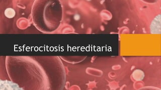 Esferocitosis hereditaria
 