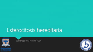 Esferocitosis hereditaria
Juan Diego Peña Niño 19171007
 