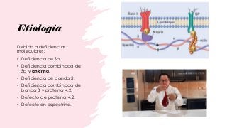 Etiología
Debido a deficiencias
moleculares:
• Deficiencia de Sp.
• Deficiencia combinada de
Sp y ankirina.
• Deficiencia de banda 3.
• Deficiencia combinada de
banda 3 y proteína 4.2.
• Defecto de proteína 4.2.
• Defecto en espectrina.
 